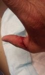 Skin Finger Hand Joint Thumb